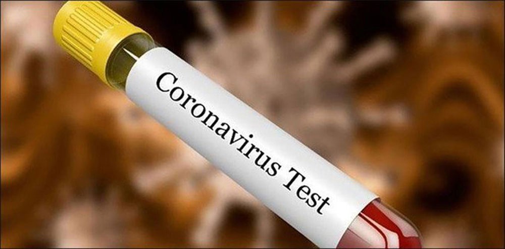 corona-test-1587879999.jpg