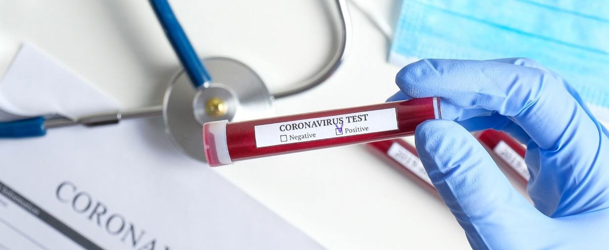 covid-19-test-corona-test-1589269340.jpg