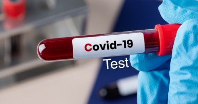 covide-test-1589350520.jpg