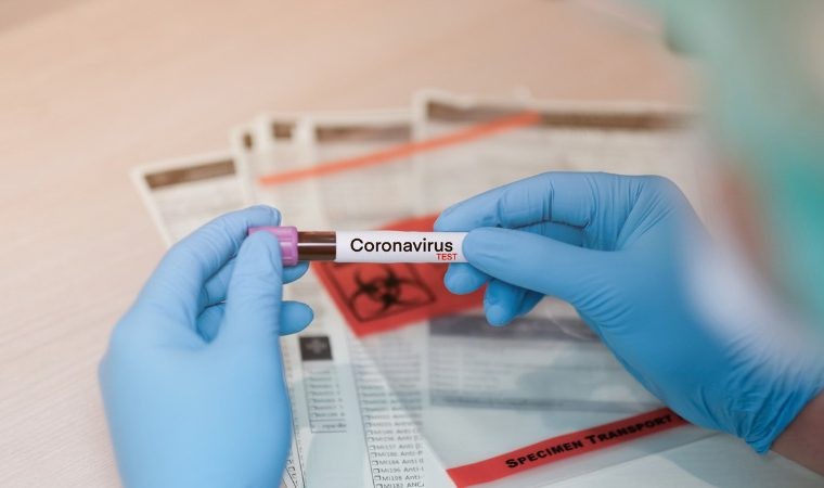 coronavirus-blood-test-in-1595516834.jpg